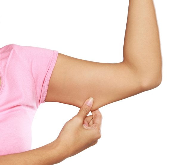 Brachioplasty or Arm Lift