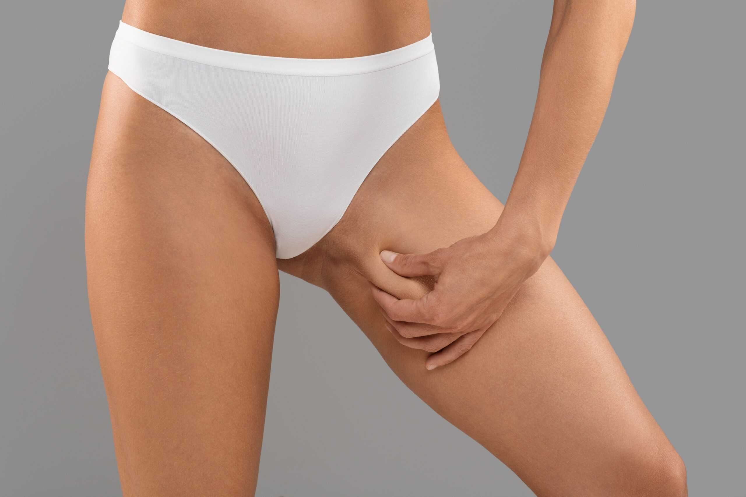 A woman in a white bikini bottom pinching the skin on her upper thigh