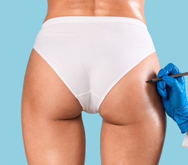 Benefits of Brazilian Butt Lifts